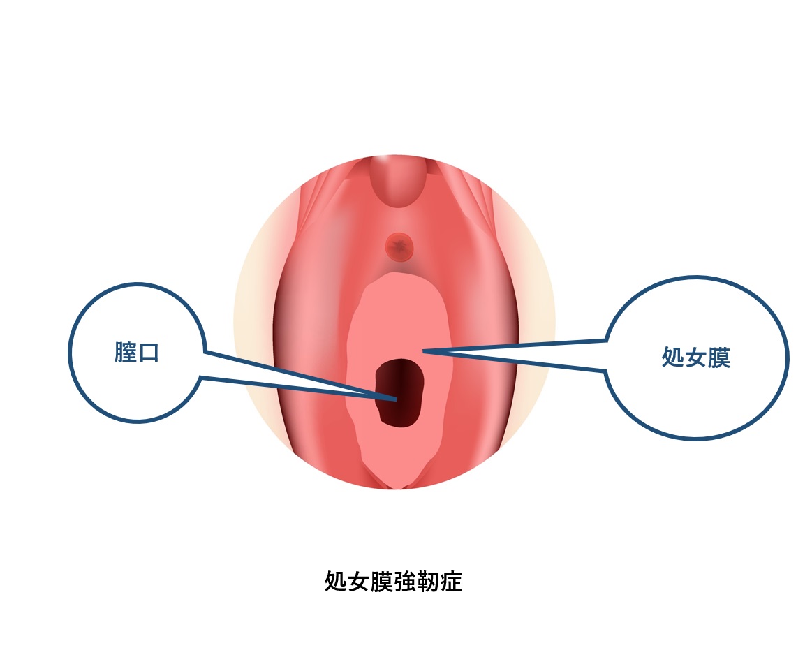 セックス 入ら ない