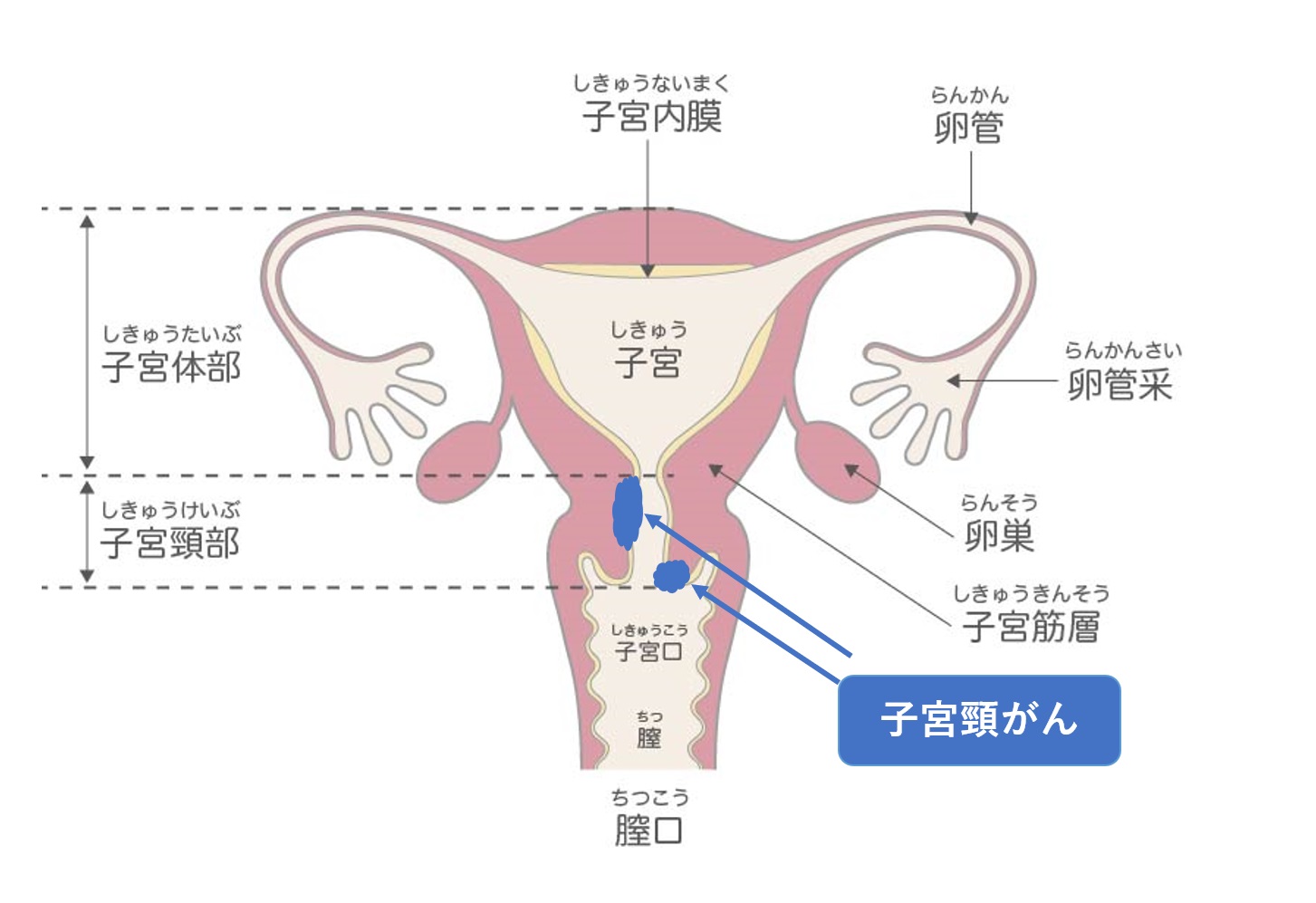 クスコ子宮 新訂第2版 写真でわかる助産技術 アドバンス [動画付] - インターメディカ 医学・看護・介護分野の映像・出版・eラーニング