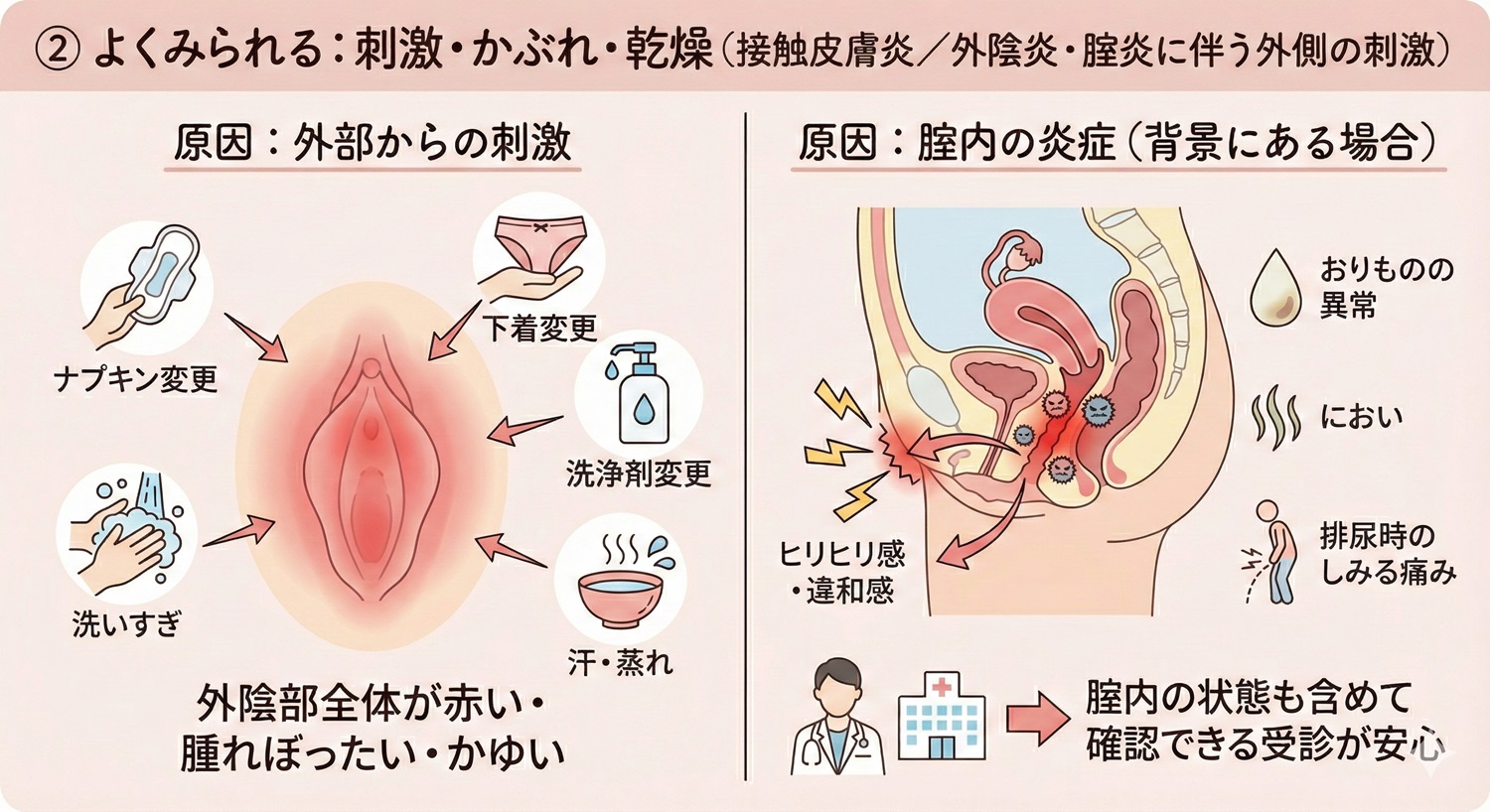 デリケートゾーン（陰部・Vライン）の 腫れ・しこり・できものが痛い・かゆい原因は？受診目安と病気一覧を婦人科医が解説。 –  港区、品川区の産婦人科で妊婦健診・産後ケア・避妊相談なら│海老根ウィメンズクリニック