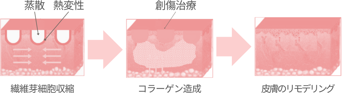 皮膚組織再生の​仕組み